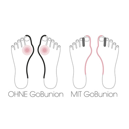 GoBunion Hallux Füßlinge