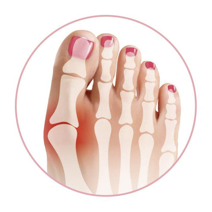 GoBunion Hallux Socken